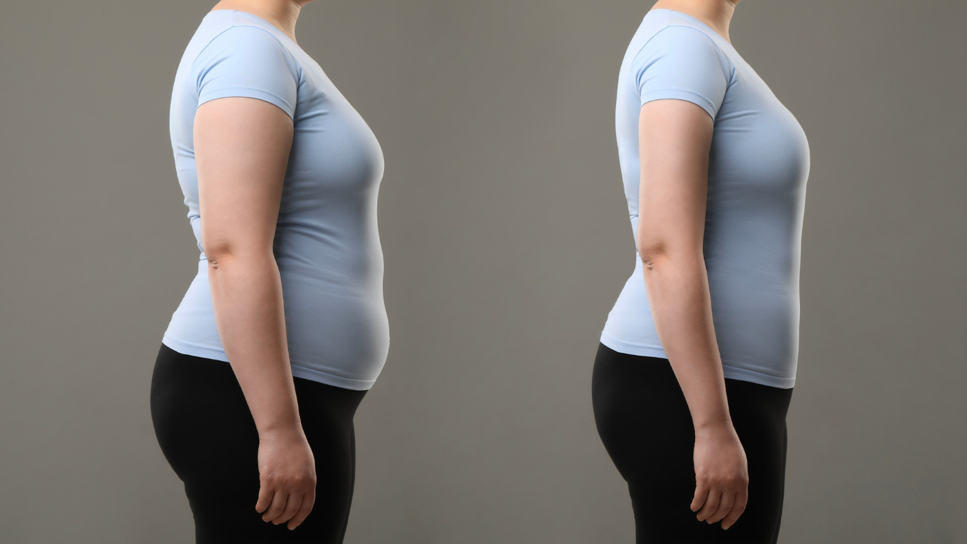 Medical Weight-Loss Injections in Ireland: Which Approach Fits You?